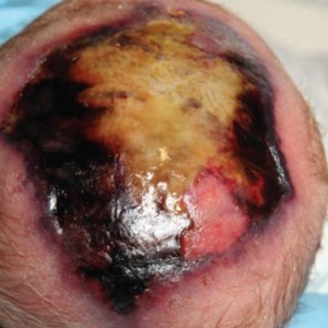 Neonaten en pediatrie